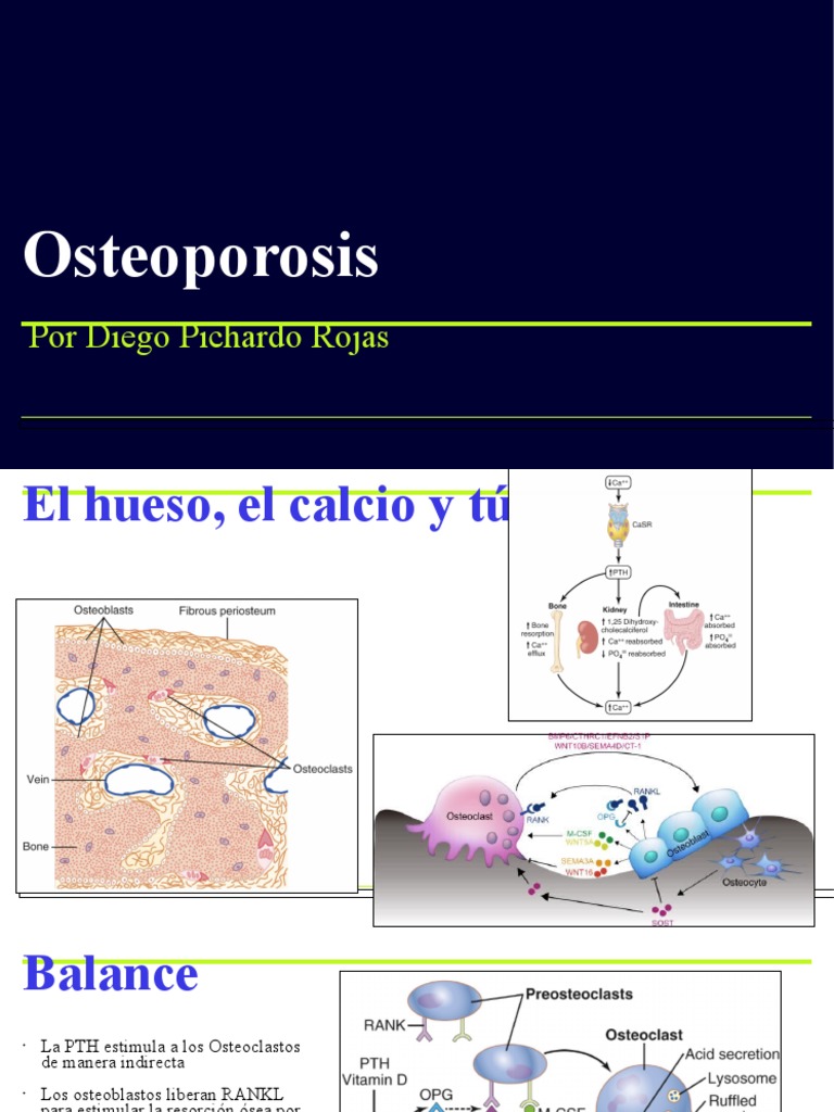 Guía Completa sobre Osteoporosis | PDF | Hueso | Osteoporosis