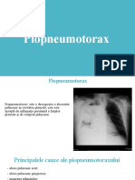 piopneumotorax