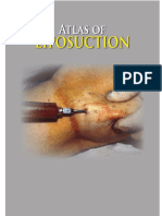 Atlas of Liposuction