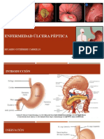 Enfermedad Ulcerosa Péptica Cirugía 2015