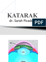 Paparan Katarak