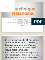 Cas Clinique Mélanome