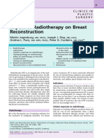 Impact of Radiotherapy On Breast Reconstruction