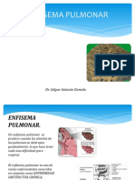 ENFISEMA PULMONAR