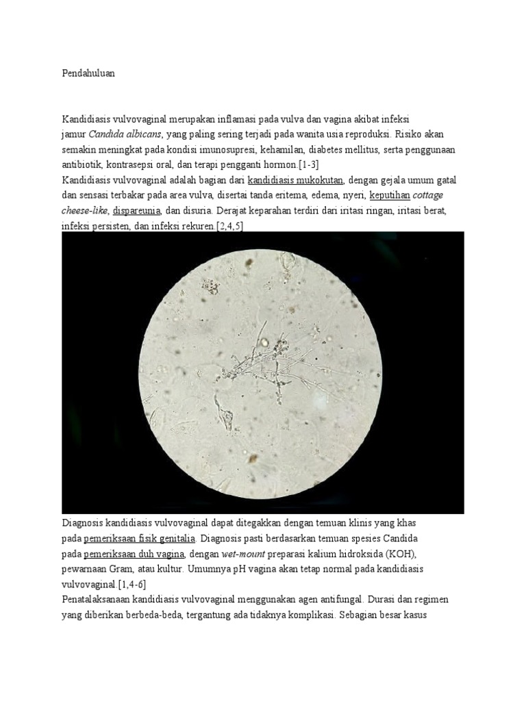 Lezbiyenlar haqida erotikani tomosha qiling