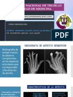 Tarea Nº4 Rx de Artritis, Osteoartrosis, Gota y Lupus. Barnard Laguna Leyla