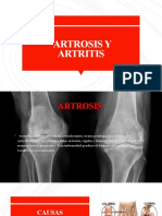artrosis y artritis
