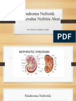 Syndroma Nefrotik GNA