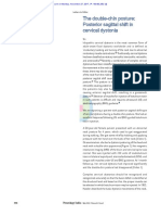 The Double Chin Posture: Posterior Sagittal Shift in Cervical Dystonia