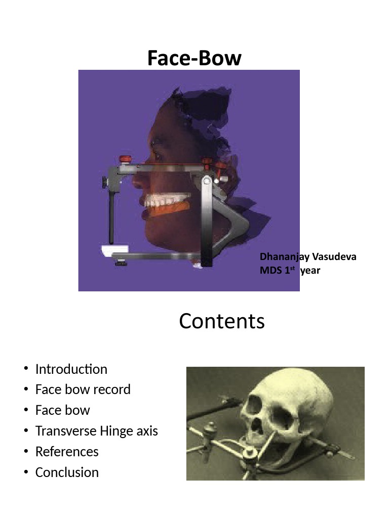 Overview of Facebow in Prosthodontics | PDF | Mouth | Dentistry