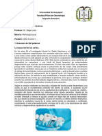 Morfología bucal: La causa real de las caries