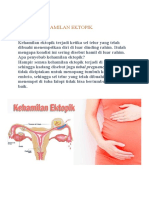 Kehamilan Ektopik Gejala dan Penanganannya