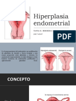 Hiperplasia Endometrial