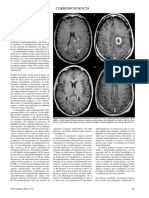 Absceso Cerebral Micotico en Inmunocompetente