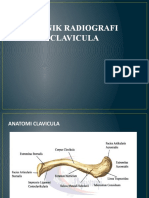 Teknik Radiografi Clavicula