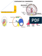 Hernias diafragmáticas congénitas: causas, tipos y tratamiento