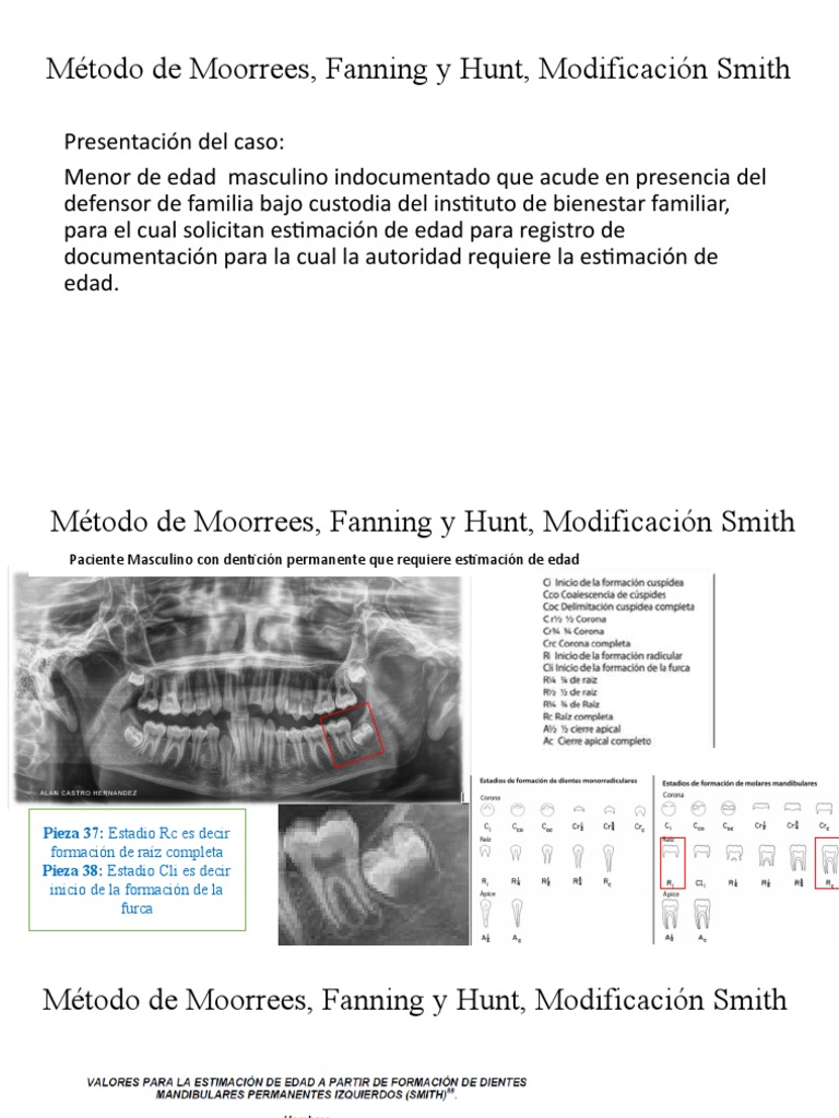 Estimación de Edad con Método de Moorrees | PDF | Política | Ciencias ...