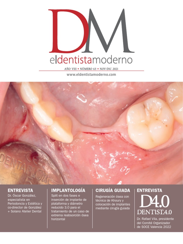 Amhismo 5134tiapsom5 | PDF | Odontología | Titanio