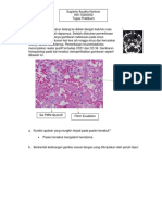 Sugianto Ayudha H - 160110200052 - Tugas Praktikum Homeostasis, Inflamasi, Perbaikan Jaringan, Gangguan Hemodinamika