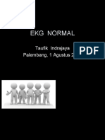 Ekg Normal