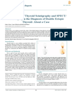 Contribution of Thyroid Scintigraphy and SPECT/ CT Imaging in The Diagnosis of Double Ectopic Thyroid: About A Case