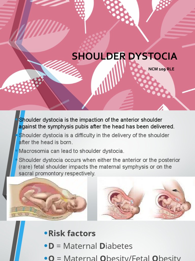 SHOULDERDYSTOCIA Edited PDF Pelvis Childbirth
