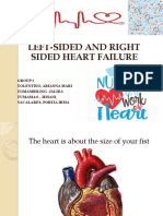 Left-Sided and Right Sided Heart Failure