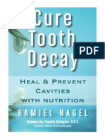 Cure Tooth Decay: Heal and Prevent Cavities With Nutrition - Ramiel Nagel