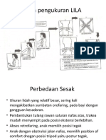 Cara Pengukuran LILA