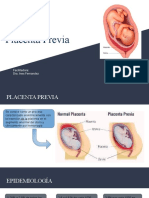 Placenta Previa Brayan
