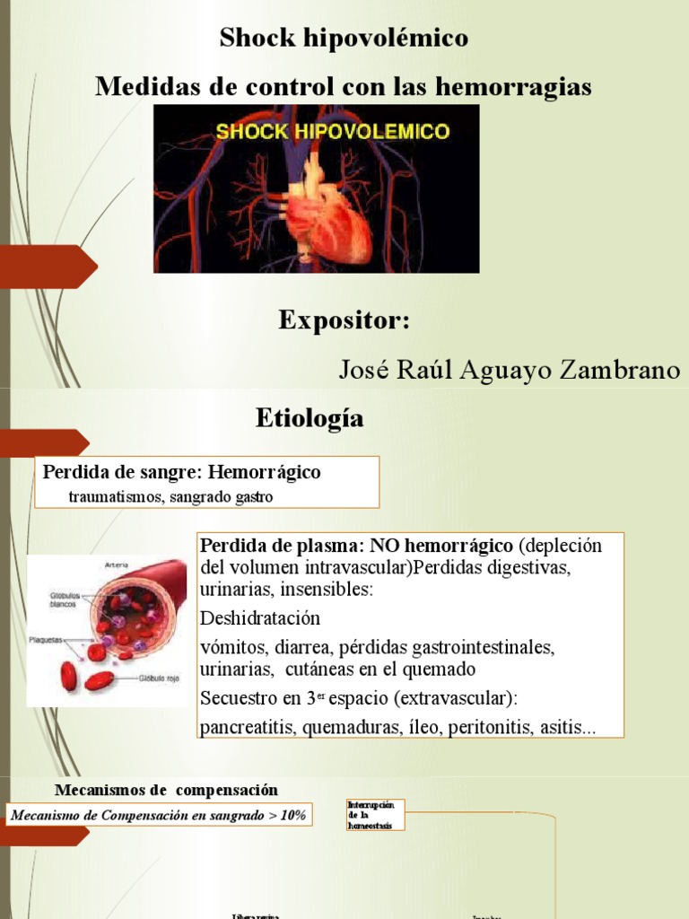 Shock Hipovolemico | PDF | Angiotensina | Fisiología