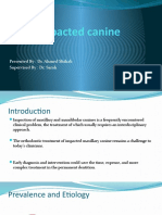 Impacted Canine: Presented By: Dr. Ahmed Shihab Supervised By: Dr. Sarah