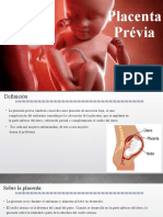 Placenta Prévia . 2021