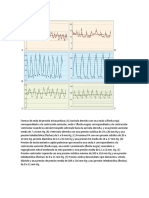 Presiones Intracardiacas