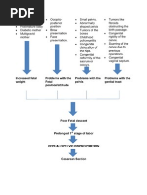 Cephalopelvic Disproportion Pathophysiology