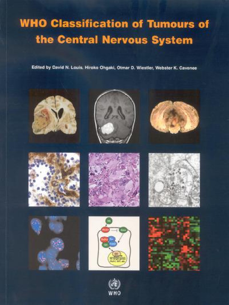 The 2024 Who Classification Of Tumors Of The Central Nervous – VXYCZ