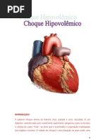 Seminario choque hipovolemico