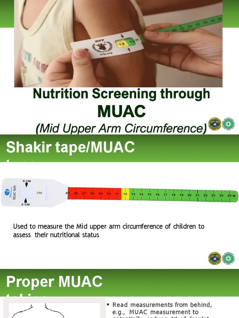MUAC Screening for Child Nutrition Assessment | PDF | Malnutrition ...