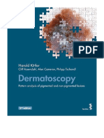 Dermatoscopy: Pattern Analysis of Pigmented and Non-Pigmented Lesions