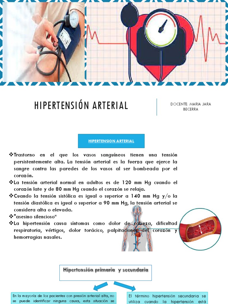 Hipertensión arterial - Trastornos del corazón y los vasos sanguíneos -  Manuale Merck versión para el público general
