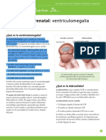 Prenatal Counseling Ventriculomegaly and Hydrocephalus (Let&#39 S Talk About..