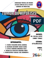 Tumor de Hipofisis