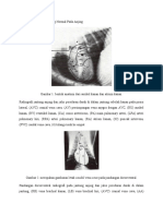 Anatomi Radiografi Jantung Normal Pada Anjing