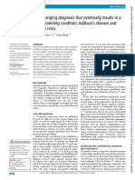 A Challenging Diagnosis That Eventually Results in A Life-Threatening Condition: Addison's Disease and Adrenal Crisis