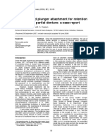 Spring Loaded Plunger Attachment For Retention of Removable Partial Denture: A Case Report