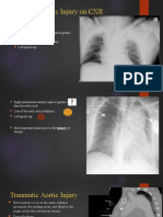 Signs of Traumatic Aortic Injury on CXR