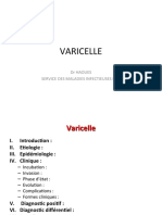 VARICELLE