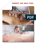 Cupping Therapy For Back Pain