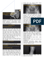 Imaging of Extremity Fractures