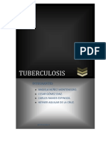 Tuberculosis